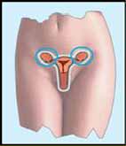 Alternative medicine. Ovarian cyst (cysts) - treatment with su jok therapy ( acupuncture ).