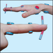 Alternative medicine.  Treatment with magnets. Su jok therapy ( acupuncture ).