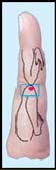 Alternative medicine. Knees pain - treatment with su jok therapy ( acupuncture ).