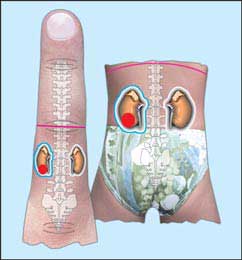 Alternative medicine. Kidneys - treatment with su jok therapy ( acupuncture ).
